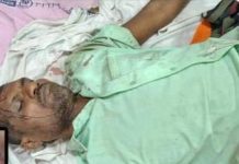 अस्वलाच्या भीषण हल्ल्यात दगडथर येथील दुसरा शेतकरी गंभीर जखमी