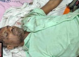 अस्वलाच्या भीषण हल्ल्यात दगडथर येथील दुसरा शेतकरी गंभीर जखमी